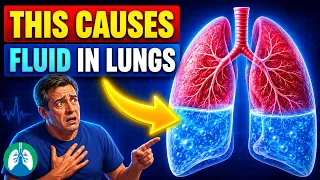 Fluid in the Lungs | Causes, Prevention, and How to Remove