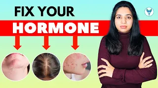 Best Diet for Hormonal Imbalance in Women | Fix Your Hormones Naturally at Home