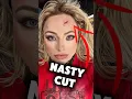 Lagu Liv Morgan SUFFERED A NASTY CUT On Raw 😱