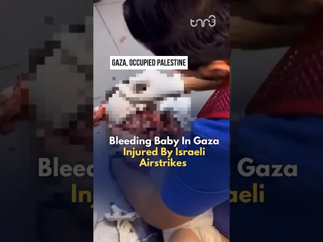 ⁣Bleeding Baby in Gaza Injured by Israeli Airstrikes
