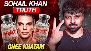 Reason Behind Sohail Khan Face - Not what you think 