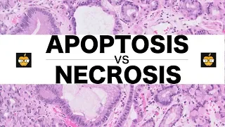 Download Apoptosis (Intrinsic, Extrinsic Pathways) vs. Necrosis MP3