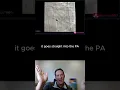 Dr Walsh gives a trick for single-access when using an Impella