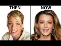 Blake Lively s NEW FACE Plastic Surgery Analysis