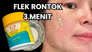 HABISI TUNTAS FLEK HITAM SECEPAT 3 MENIT!!