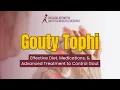 Gouty Tophi Effective Diet Medications Advanced Treatment to Control Gout