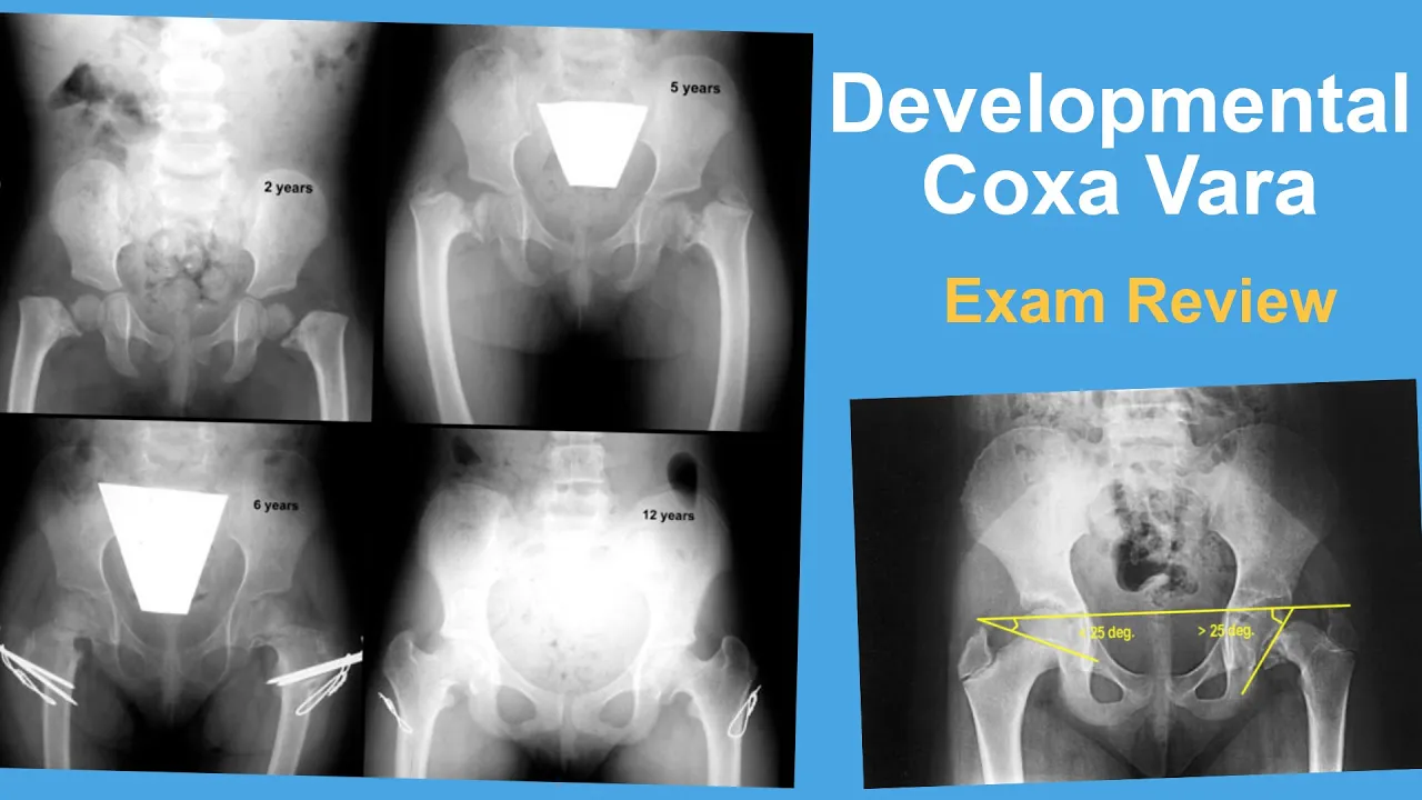 Jan Szatkowski, MD Associate Professor, Orthopaedic Trauma Follow Us On Social Media: Twitter: https. 