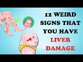 Download Lagu Warning: 12 Weird Signs That Show You're Having Liver Damage