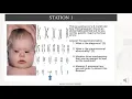 Download Lagu Down Syndrome