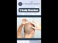 5 Scalp Disorders