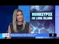 WATCH NEWS12LI Monkeypox on Long Island