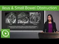Bowel Obstruction and Ileus Ileus Small Bowel Obstruction - Radiology Lecturio