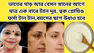 দুই চামচ ভাতের মাড়ের সাথে একটু বেসন ব্যাস গরমের ত্বকের সব সমস্যা দূর।ফর্সা হওয়ার সহজ উপায়।DTan Pack