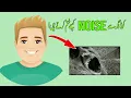 Image Denoising using Python Script Python Automation Projects