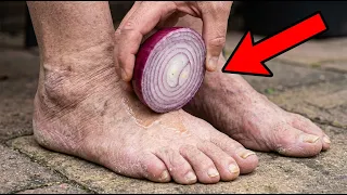 Why You Should Put Onions on Your Feet Before Bed
