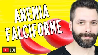 ANEMIA FALCIFORME | Biologia com Samuel Cunha