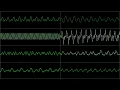 Secret of Mana - Into the Thick of it (Extended) - In Oscilloscope View!