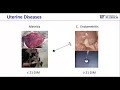 Uterine Health and Potential Connection with Genetic Variation