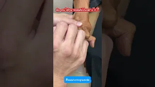  ทำไมนิ้วมือของคนไข้ที่เป็นโรคข้ออักเสบรูมาตอยจึงผิดรูป 