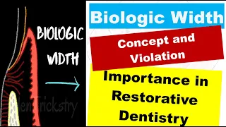 Biologic Width Supracrestal Tissue Attachment Violation Importance in Restorative Dentistry