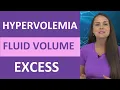 Hypervolemia - Fluid Volume Excess Overload Nursing NCLEX Water Intoxication