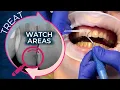 How to Apply Curodont Repair Fluoride Plus A Step-by-Step Guide