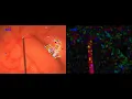 Comparison btw Lucas-Kanade and Dense Optical Flow