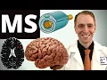 Multiple Sclerosis Overview Risk Factors Diagnosis Treatment Diet