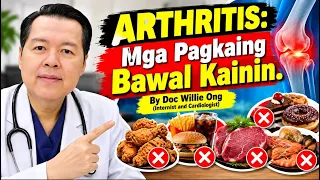 Arthritis: Mga Pagkaing Bawal Kainin - By Doc Willie Ong (Internist and Cardiologist)