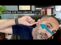 HOW TO Use Ear Drops