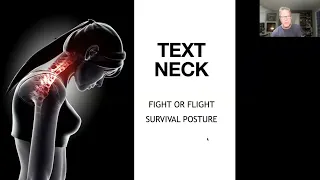 Text Neck Platysma Muscle Exercise