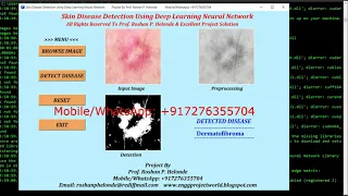 Skin Disease Detection Using Deep Learning Neural Network Source Code Python OpenCV Project