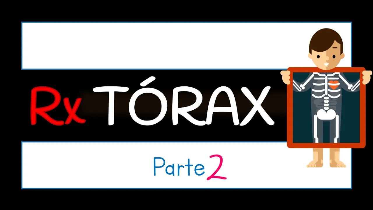 Radiografía de Tórax - anatomía radiológica y Interpretación de una radiografía de tórax