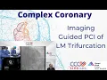 Lagu Imaging Guided PCI of LM Trifurcation
