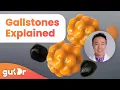Gallstones - What Are the Causes and Symptoms The GutDr Explains 3D Gut Animation