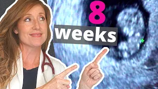 Download 8 Week Ultrasound | PLUS how to Help with Morning Sickness MP3