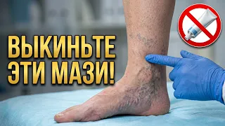 Варикоз на ногах: что реально помогает, а что бесполезно