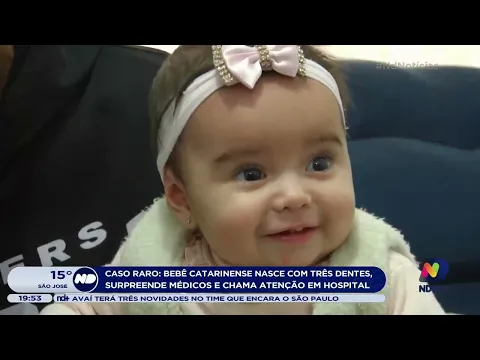 Bebê catarinense nasce com três dentes e chama atenção em hospital