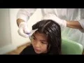 Full Service Lice Removal Treatment - Lice Clinics of America