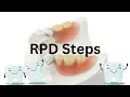 RPD step by step procedure SIMPLIFIED