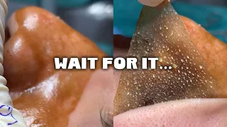 Peel Off Face Mask ASMR Compilation (Oddly Satisfying Skincare)