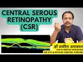 Download Lagu CSR : Central Serous Retinopathy. STRESS की वजह से आँख के पर्दे में सूजन l