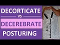 Decerebrate vs Decorticate Posturing Rigidity Mnemonic Pictures Nursing NCLEX