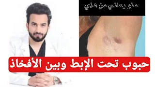 حبوب تحت الابط   علاج حبة مدفونة تحت الإبط بدون رأس مؤلمة دندنها