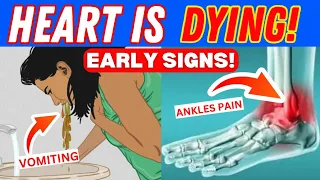 Download The Early 12 Weird HEART ATTACK Signs And Symptoms to Know | AFTER 50 MP3