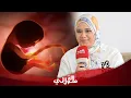 Lagu حالة نادرة لزوجة مغربية تعاني من مشكل الإجهاض المتكرر \