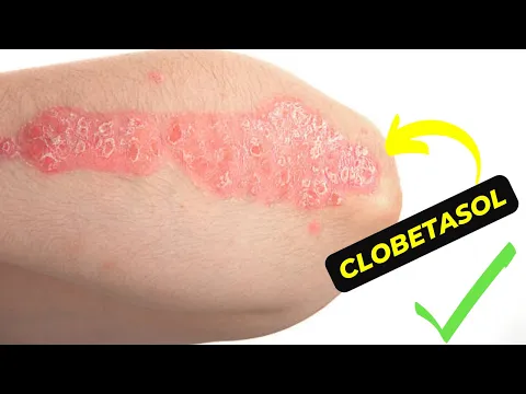 Download MP3 The Ultimate Guide to Clobetasol: How to Effectively Treat Skin Conditions