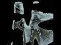 Ataraxia