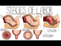 Lagu Stages of Labour Made Easy (Including The 3P's and Cardinal Movements!)