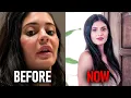 New Leaked Photos Kylie Jenner s Old Face Is BACK After Years Of Filler